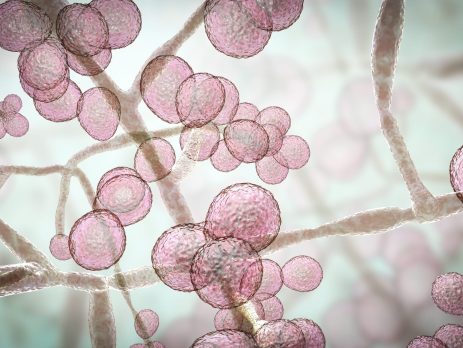 candida and headaches – i feel absolutely amazing