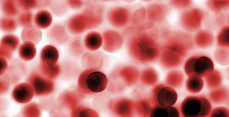 live blood analysis and mindset made a difference