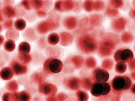 live blood analysis and mindset made a difference