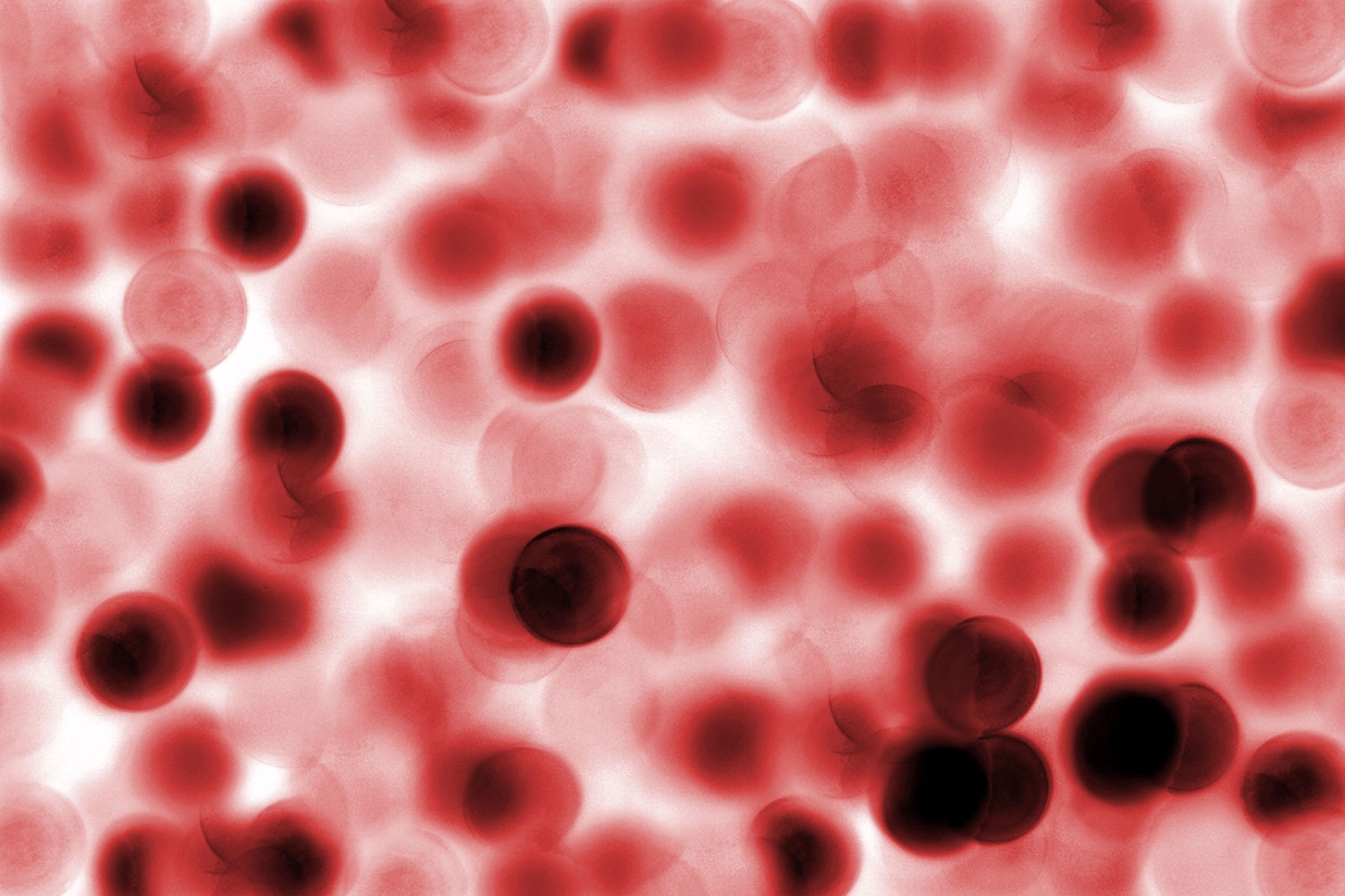 live blood analysis and mindset made a difference