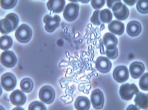 live blood analysis live blood analysis